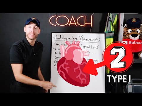 UNDERSTAND 2nd Degree Heart Block Type I