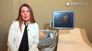4D Ultrasonografisi hakkında bilinmesi gerekenler