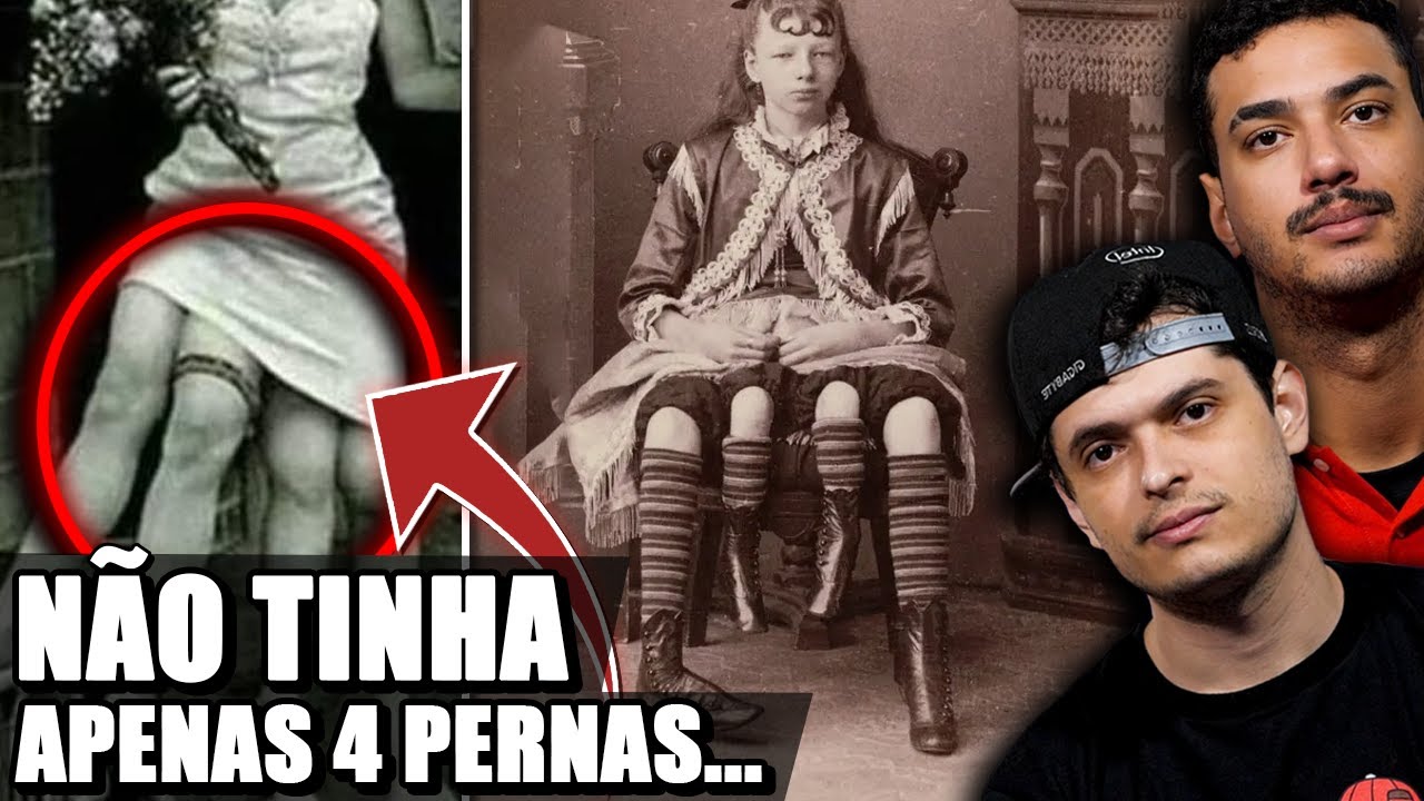 CONHEÇA A MULHER QUE NASCEU COM QUATRO PERNAS