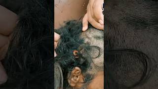 Download lagu How come a millipede is nesting in this man's head? #odgj #egoadriano mp3