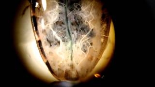 Locust heart beating