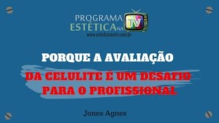 PORQUE A AVALIAÇÃO DA CELULITE É UM DESAFIO PARA O PROFISSIONAL