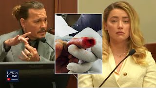 Amber Heard Allegedly Threw Glass Bottle at Johnny Depp That Severed His Finger