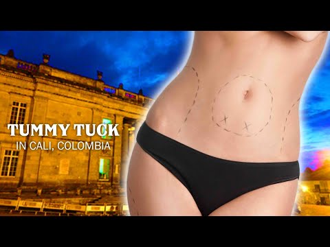 Effective Package for Tummy Tuck in Cali, Colombia