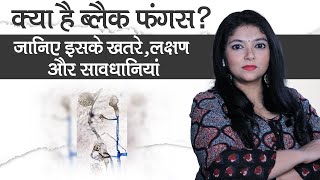 Black Fungus: Side Effects Symptoms Precautions | ब्लैक फंगस के खतरे, लक्षण और सावधानियां