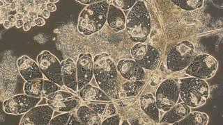 How to Reduce SVI & Foam in Activated Sludge Plants
