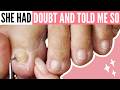 Toenail Pain Relief, Curling Toenails & Nail Trauma Recovery Pedicure