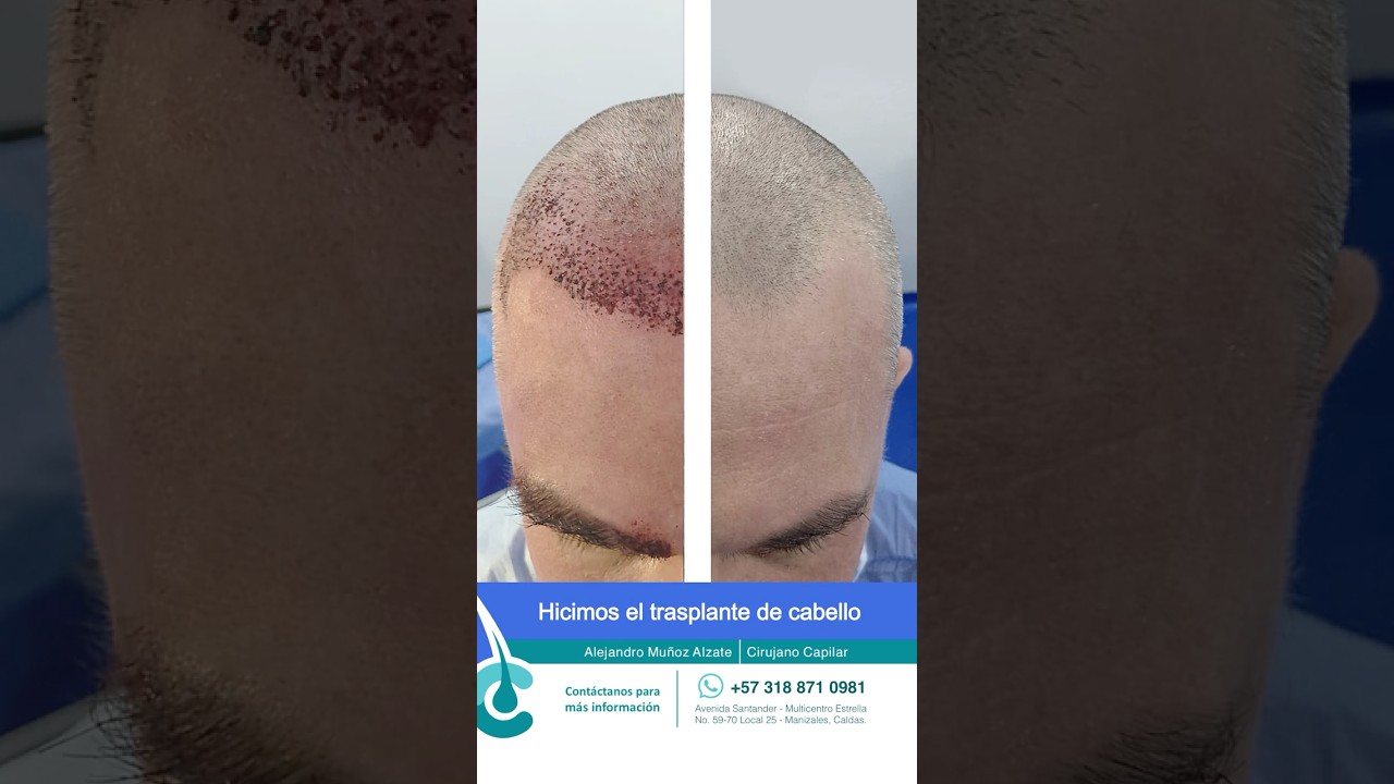 Alejandro Muñoz Alzate-8