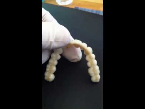 CHF 25,000 - Swiss Specialist  Dr Garry Bonsall - 14 diamond crowns -  in Basel