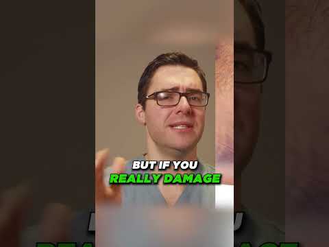 Why Is My Sprained Ankle Still Swollen After 3 6 or 12 MONTHS