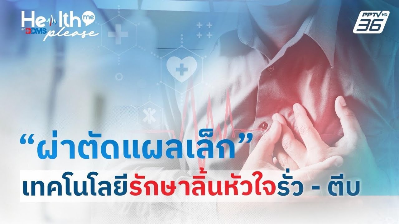 “ผ่าตัดแผลเล็ก” เทคโนโลยีรักษาลิ้นหัวใจรั่ว – ตี?