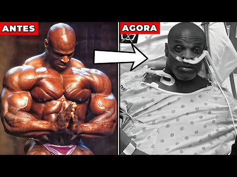 O que Aconteceu com os Campeões do Mr. Olympia?!