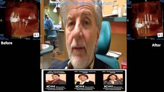 Multiple Implants Fremont - Implant Dentist in Fremont - Patient Testimonials
