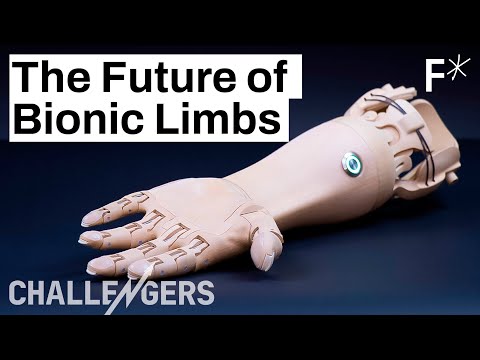 The New Generation of Prosthetics