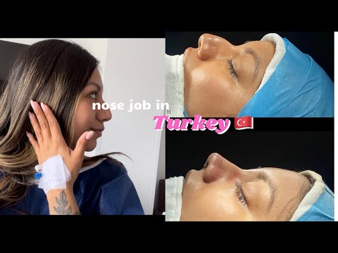 I WENT TO TURKEY FOR A NOSE JOB ..ALONE | surgery details & process