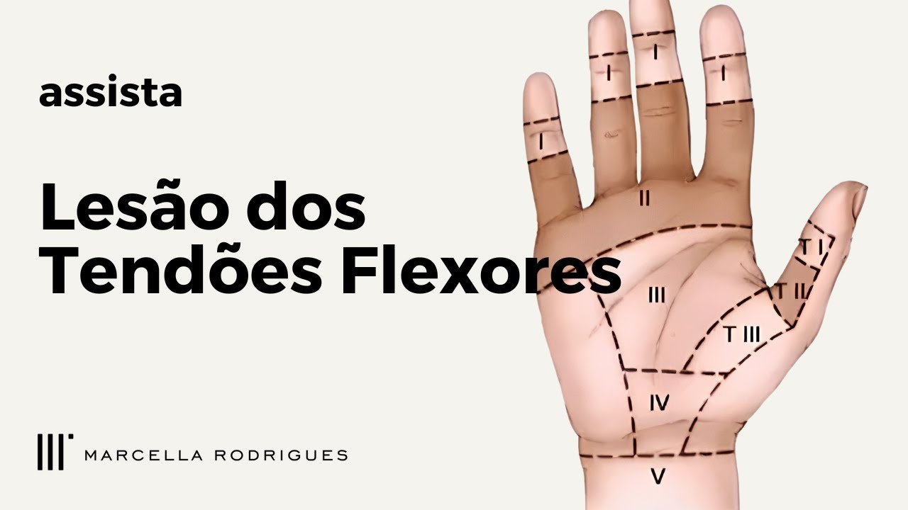 Lesão dos Tendões Flexores