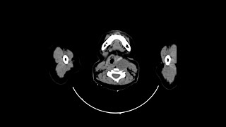Case of the Day - 2 Dec 24