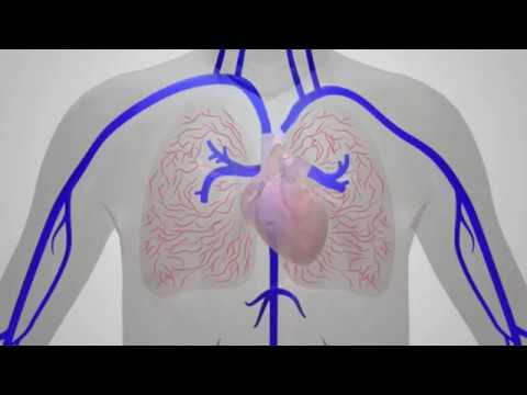 a pulmonalis keringés hipertóniájának patogenezise