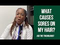 What causes Sores on my Scalp?