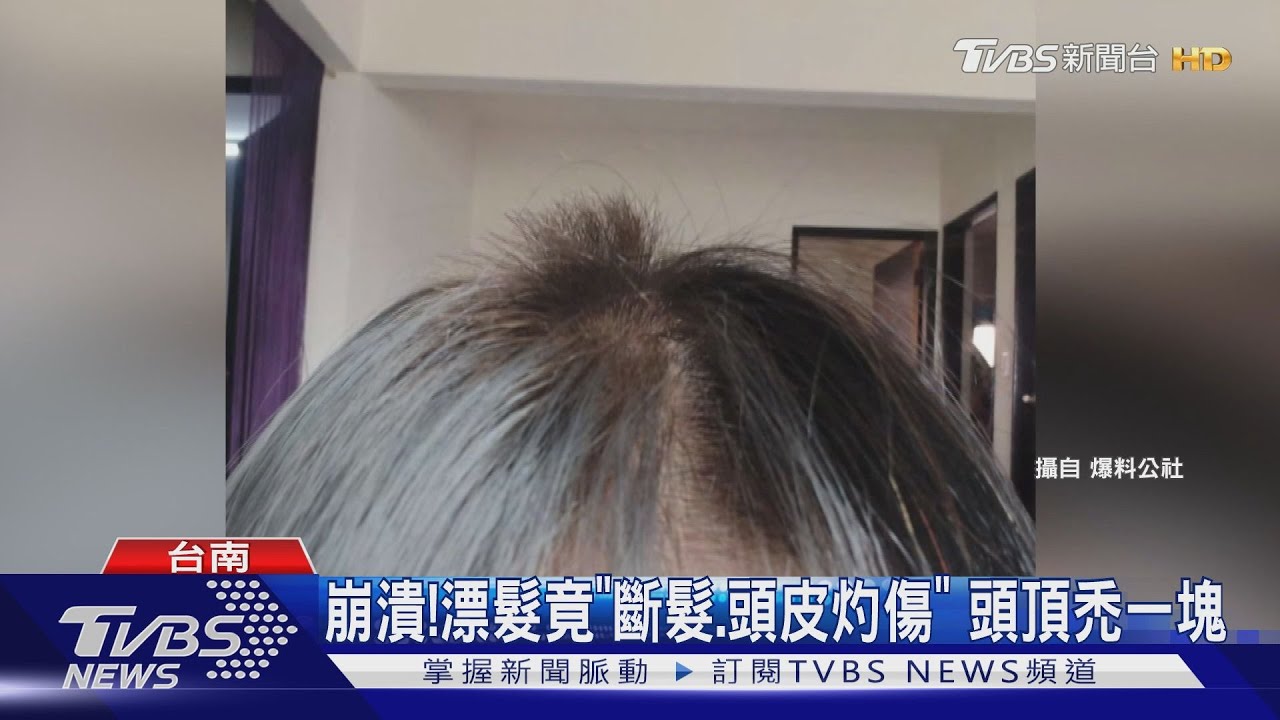 崩潰！漂髮竟「斷髮、頭皮灼傷」　投訴消保官