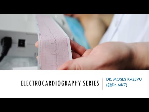 Dr MK's ECG  Part 5 (Conduction problems)