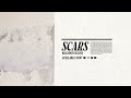 Scars
