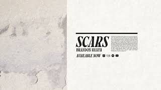Scars