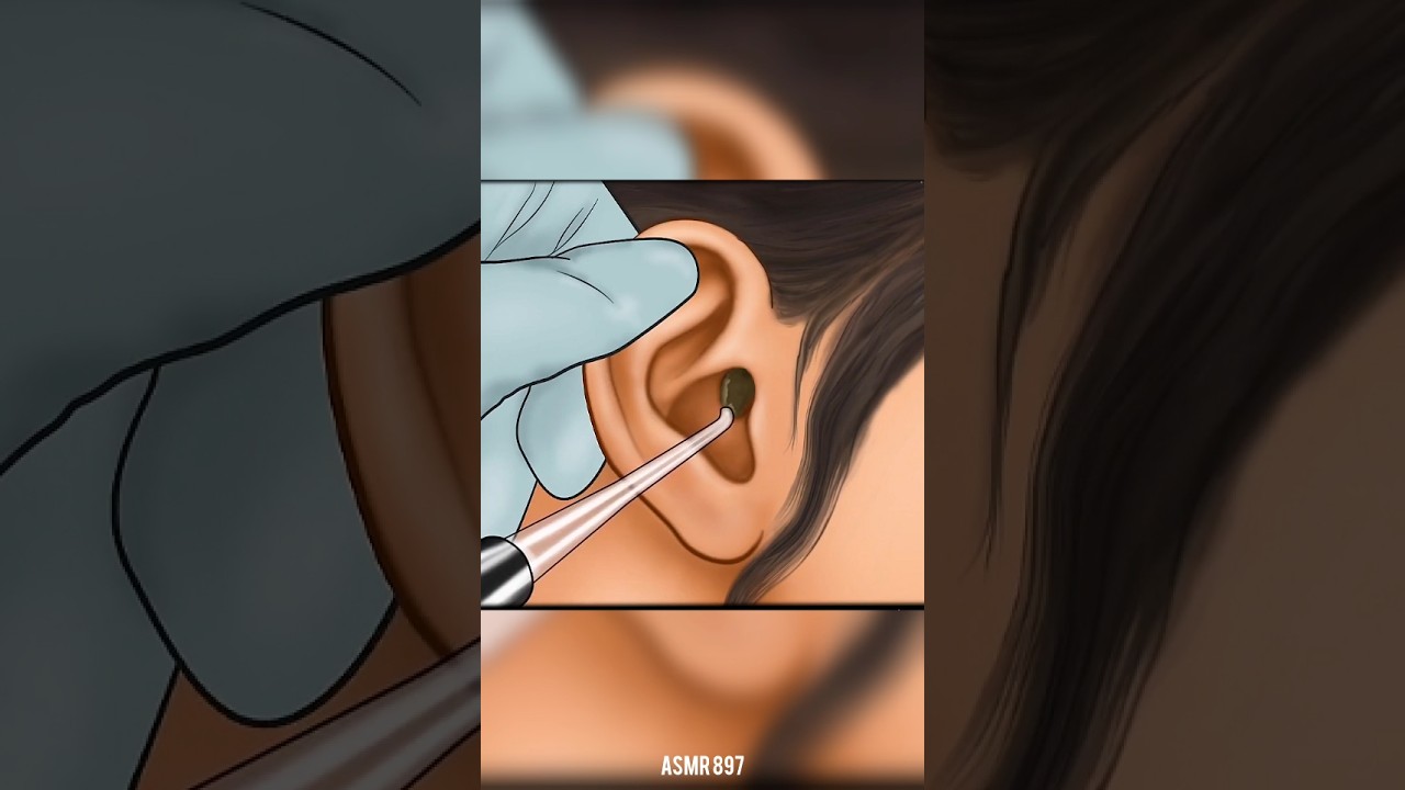 asmr ear cleaning and ear wax removal #satisfying #asmr#asmrsounds #shorts #animation