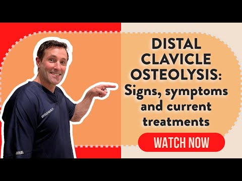 Distal clavicle osteolysis: Signs, symptoms and current treatments