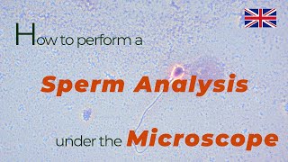 How to perform a sperm analysis under the microscope | urologist göttingen