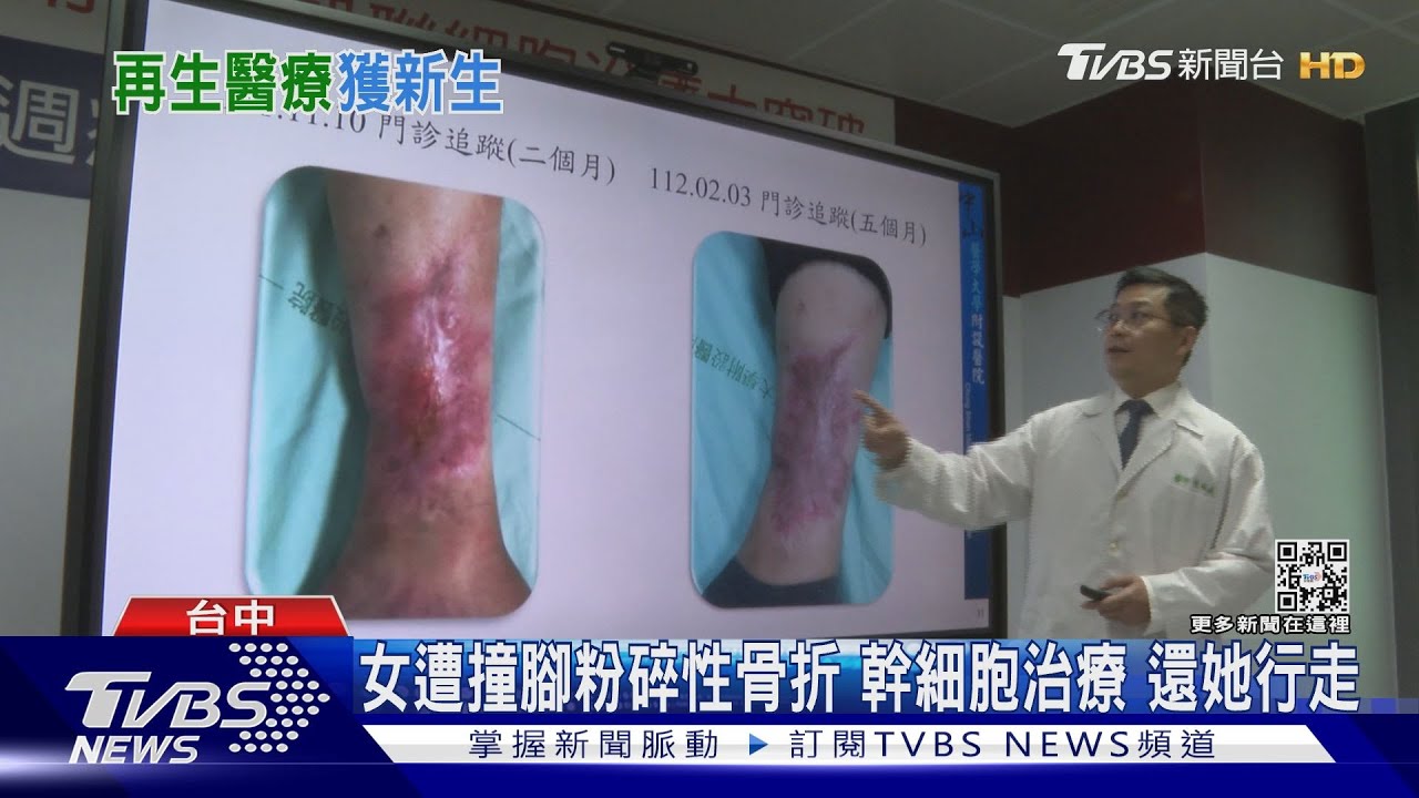 女遭撞腳粉碎性骨折！幹細胞治療　還她行走