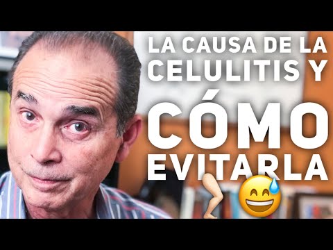 Episodio #20 La Causa De La Celulitis Y Como Evitarla