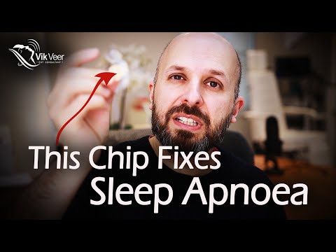 Genio Implant for Sleep Apnoea