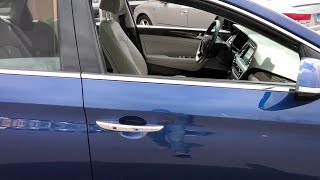 2015 Hyundai Sonata Chicago, Countryside, Aurora, Naperville, Oaklawn, IL 80472A