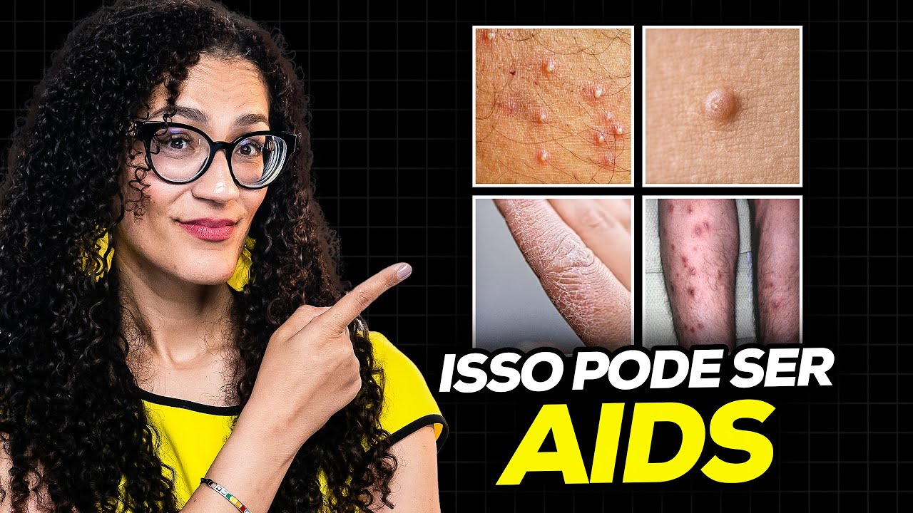 AIDS - Quando Suspeitar Da AIDS