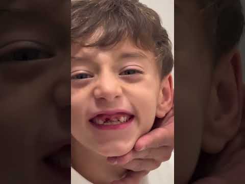 SE ME CAYÓ UN DIENTE POR ACCIDENTE 😱😳 #minivlog #maternidad #momlife #shortvideo