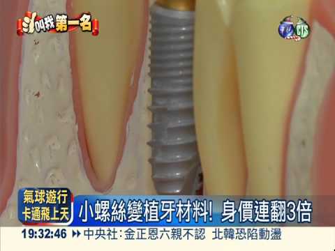 "小螺絲"立大功! 台植牙進軍國際