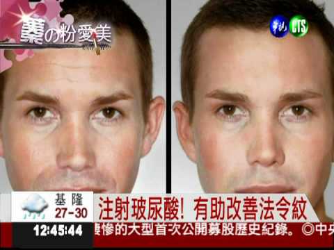 微整形加持! 擁有少女"蘋果肌"