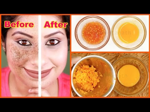 Remove Dark Spots From Skin Naturally || Anti Freckle...