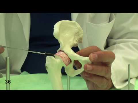 Es behandelt sowohl Knie Arthritis Über das Kloster Tee aus Osteochondrose