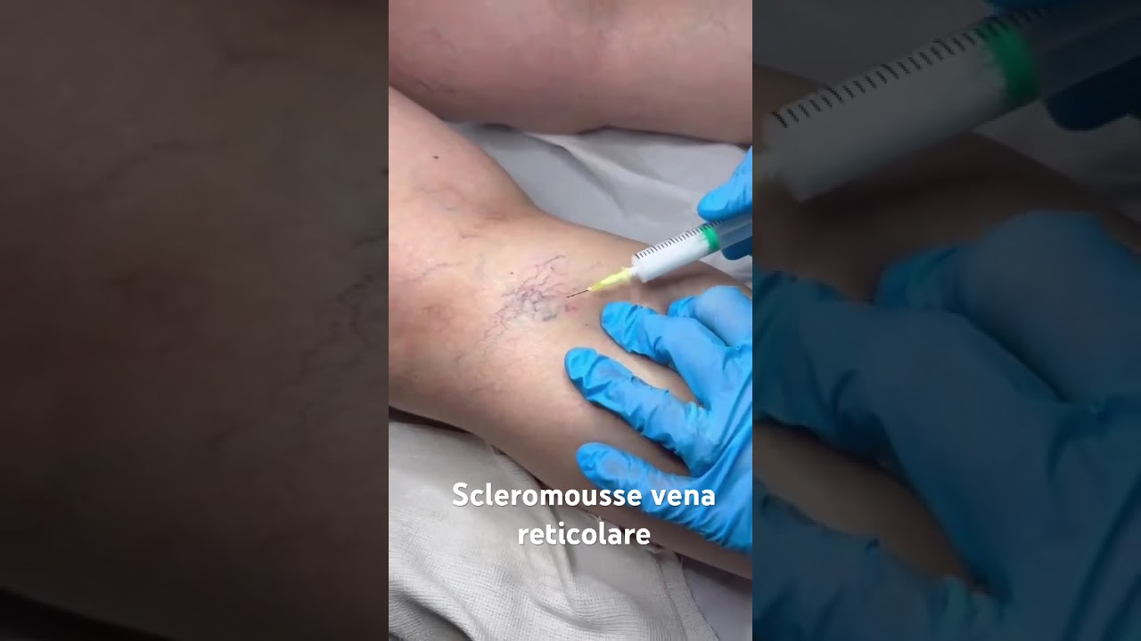 Vincenza Capuozzo-10