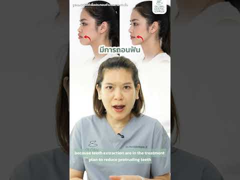 Can orthodontic treatment change your face?