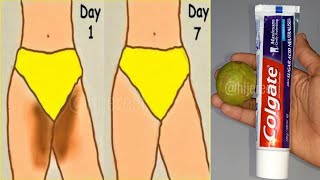 HOW TO GET RID OF DARK INNER THIGHS INSTANTLY | 100% WORKS