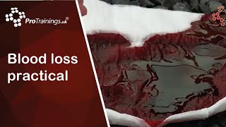 Blood loss practical - how do you se how much blood has been lost?