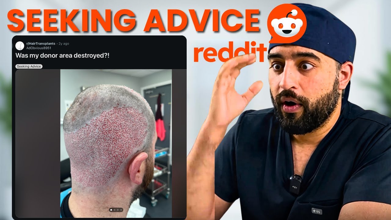 Hair Transplant Surgeon Reacts to Shocking Reddit Posts (Part 1)