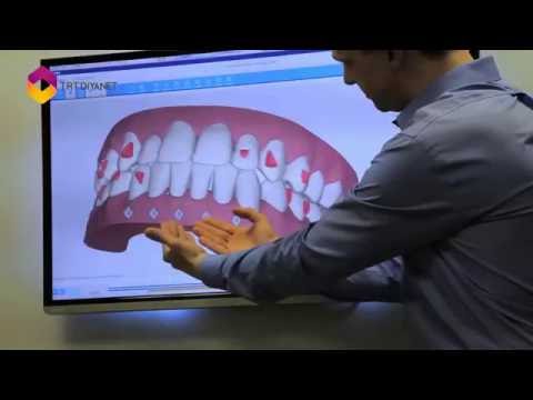 Vtr Hangi Ortodontik Problemlerde Hekime Gidilmeli 