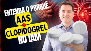 Por que AAS e CLOPIDOGREL no IAM?
