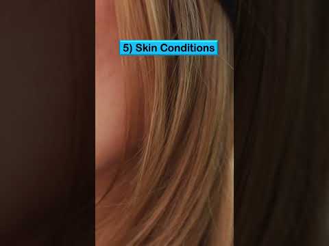 Meniere s Disease Signs Symptoms Why They Occur