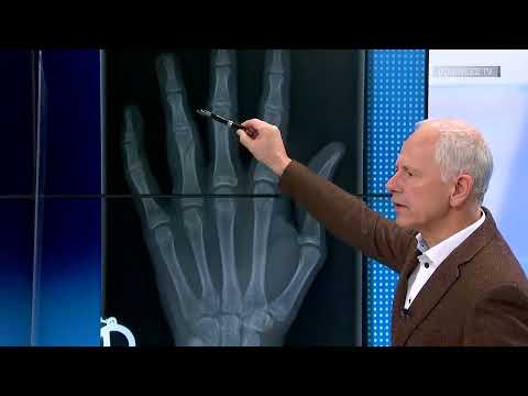 Hessingpark-Clinic I a.tv Gesundheit I Metatarsalgie - Schmerzen am Ballen