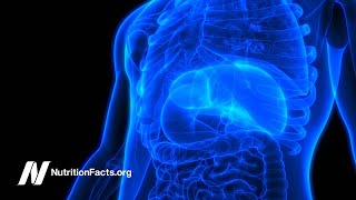 Using Diet to Prevent Non-Alcoholic Fatty Liver Disease